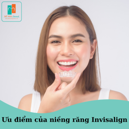 ưu điểm của niềng răng Invisalign