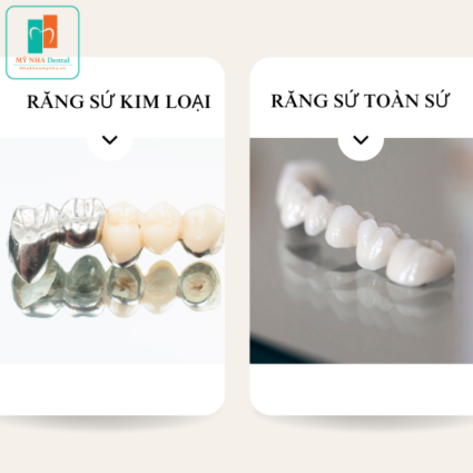 răng sứ kim loại và răng sứ toàn sứ