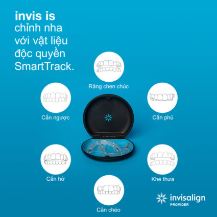 các trường hợp nên niềng răng Invisalign