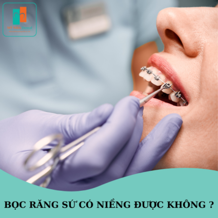 bọc răng sứ có niềng được không