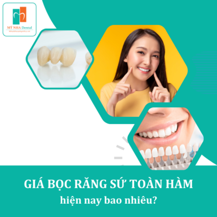 giá bọc răng sứ toàn hàm